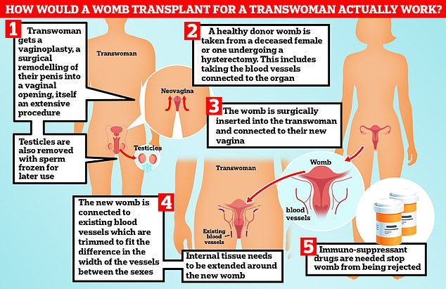 How would a womb transplant work for a trans women – TodayHeadline