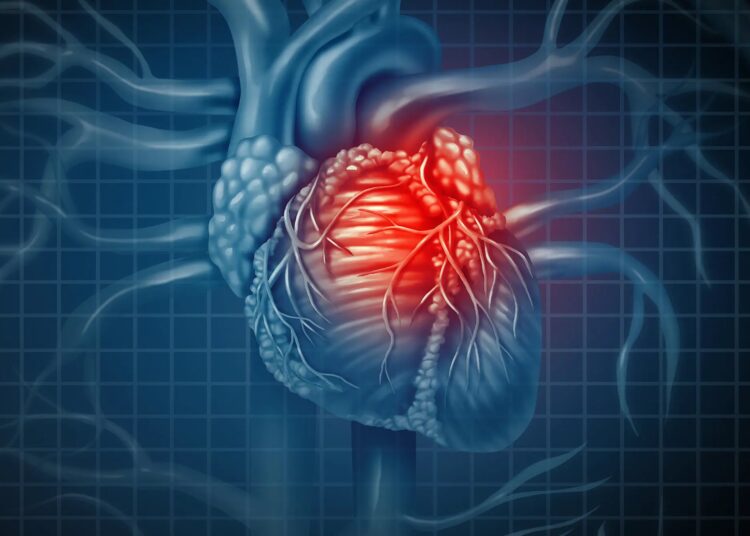 Heart Disease Concept – TodayHeadline