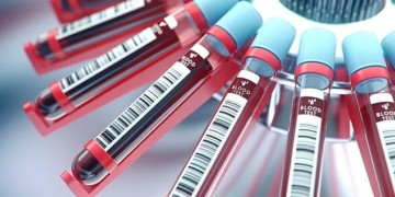Scientists develop gene test to tell if blood cancer drugs – TodayHeadline