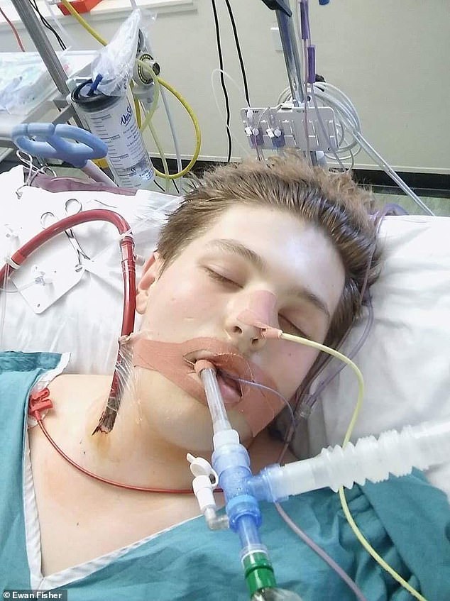 While aimed at children the devices can reap a catastrophic toll on young people. Pictured here is Ewan Fisher at age 16 who spent weeks in intensive care after his lungs failed the night before he was due to start his GCSE exams due to an allergic reaction to vape chemicals