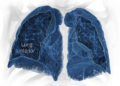 virus 3d lung promo facebookJumbo – TodayHeadline