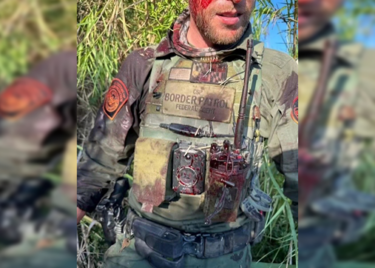 Former Texas Congresswoman Mayra Flores Shares Bloody Photo of Border Patrol Agent After Alleged Attack By Illegal | The Gateway Pundit