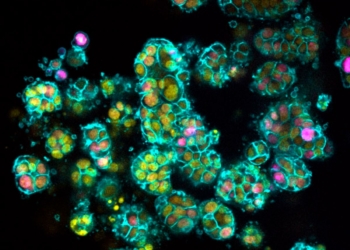 Pancreatic Cancer Cells 1 jpg