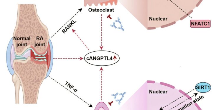 Biomarker discovery offers a novel therapeutic approach for rheumatoid arthritis