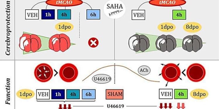 Cerebral stroke in animal models with hypertension found to affect arteries in other body regions