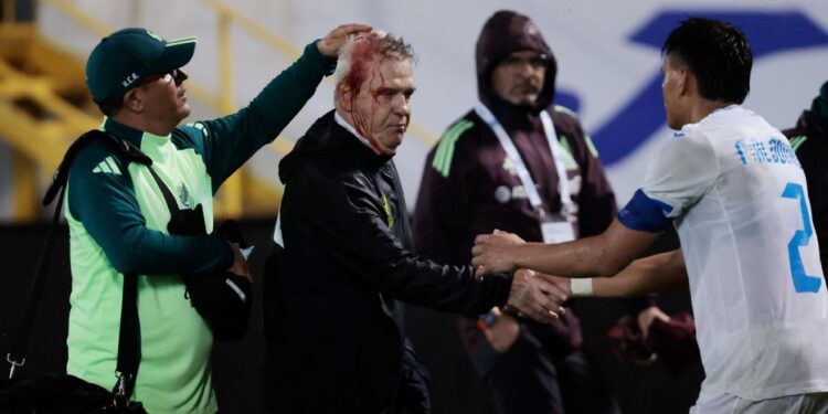 Mexico coach hit in head by beer can in Honduras