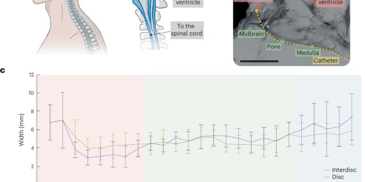 Minimally invasive neural interface allows brain access without skull opening