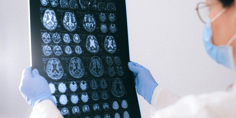 Radiologists could soon be using AI to detect brain tumors