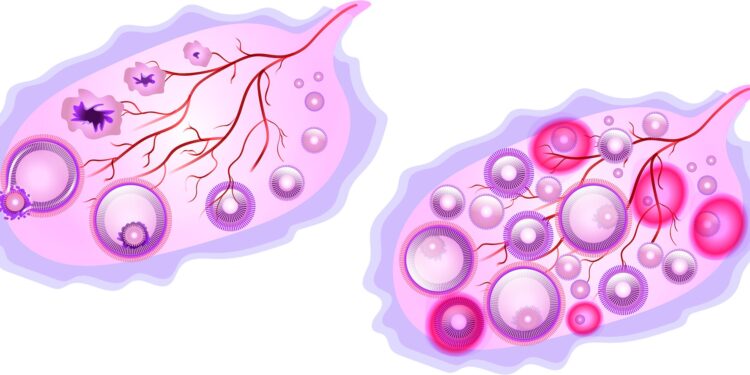 Researchers discover new combination therapy approach for metastatic ovarian cancer