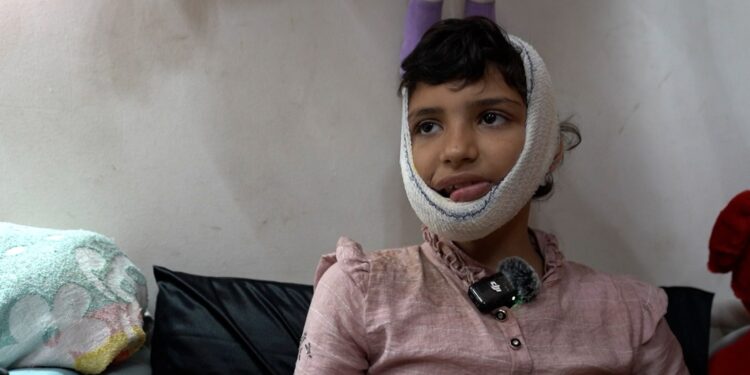 Severe injuries change 12-year-old Mazyouna’s life in Gaza