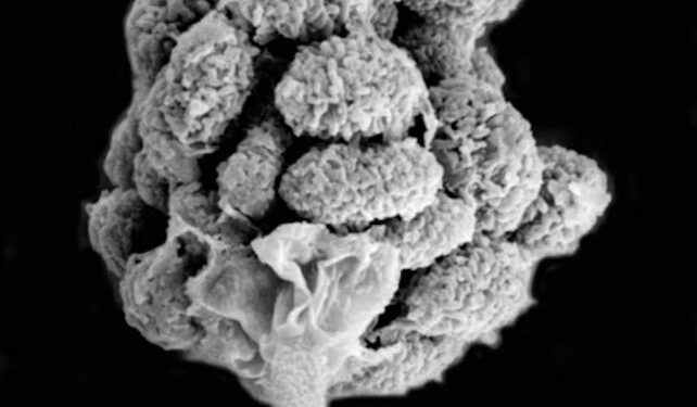 Black and white microscopic image of broccoli-like mold spore