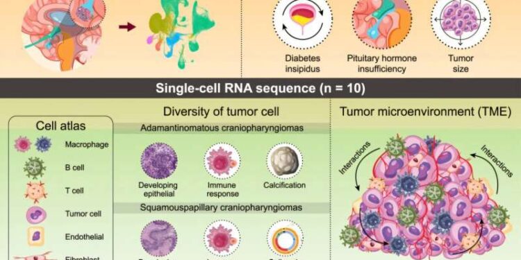 Immune cell map offers insights into rare brain tumor