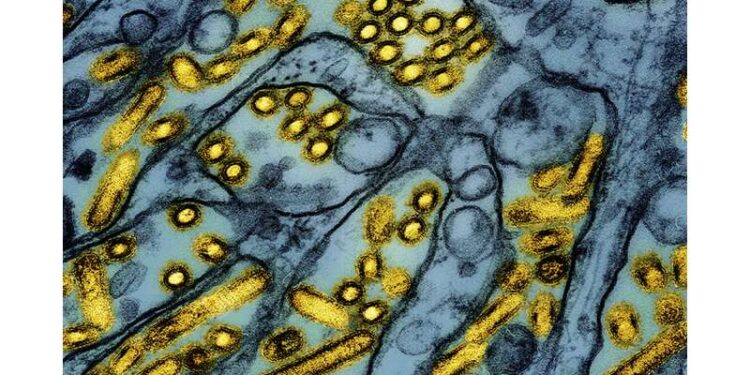 Health officials say Louisiana patient is first severe bird flu case in US