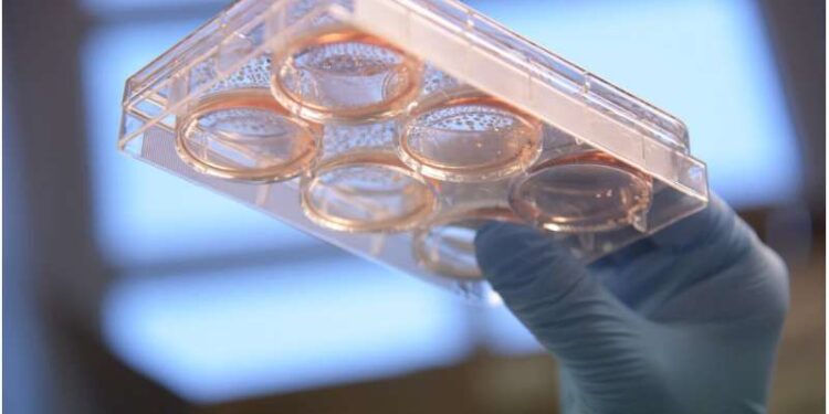 Breakthrough in stem cell research: Mini-brains provide insight into mitochondrial diseases