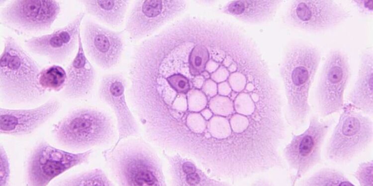 cancer cell