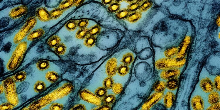 US identifies 65-year-old in Louisiana as first severe case of bird flu