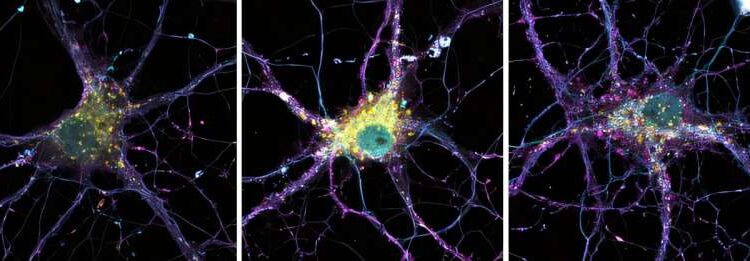 The genetic roots of rare mutations in Alzheimer's disease