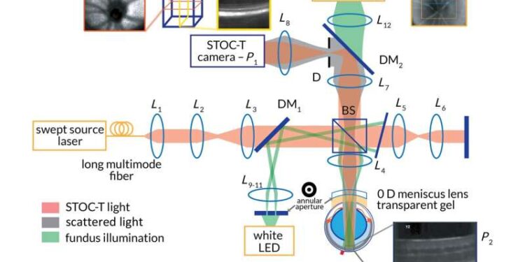 How we can use STOC-T to assess ocular microcirculation